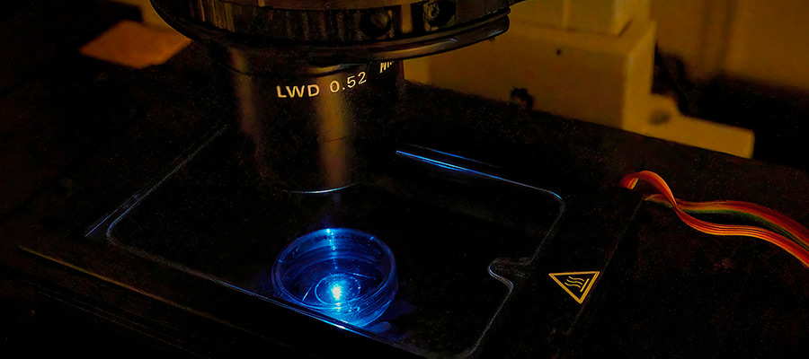 Fluorescensavbildning av levande celler i ett konfokalmikroskop